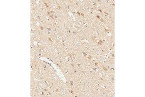 Immunohistochemical analysis of paraffin-embedded human brain tissue using (ABIN6242603 and ABIN6578838) performed on the Leica® BOND RXm. (RGMB antibody)
