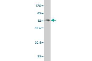 Western Blot detection against Immunogen (59. (MEOX2 antibody  (AA 1-303))