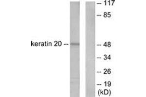 Western blot analysis of extracts from HeLa cells, using Keratin 20 Antibody. (KRT20 antibody  (AA 375-424))