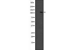 Western blot analysis of GRIP1 expression in fetal muscle lysate ,The lane on the left is treated with the antigen-specific peptide. (GRIP1 antibody  (Internal Region))