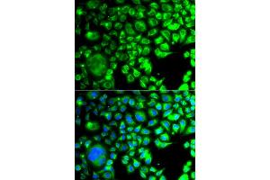Immunofluorescence analysis of A549 cells using TBPL1 antibody (ABIN5975608). (TBPL1 antibody)