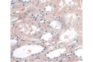 IHC-P analysis of Human Kidney Tissue, with DAB staining. (APOA1 antibody  (AA 122-267))