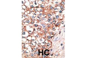 Immunohistochemistry (IHC) image for anti-Gap Junction Protein, alpha 10, 62kDa (GJa10) antibody (ABIN2998438) (GJa10 antibody)