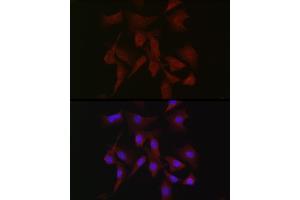 Immunofluorescence analysis of NIH-3T3 cells using PRKCB Rabbit pAb (ABIN6128462, ABIN6146199, ABIN6146201 and ABIN6217699) at dilution of 1:50 (40x lens). (PKC beta antibody  (AA 1-270))