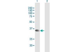 Western Blot analysis of STX16 expression in transfected 293T cell line by STX16 MaxPab polyclonal antibody. (Syntaxin 16 antibody  (AA 1-304))