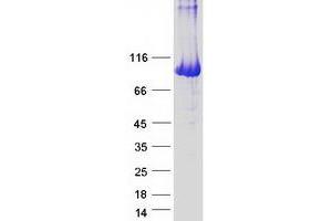 Validation with Western Blot (PYGL Protein (Myc-DYKDDDDK Tag))