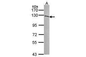 Image no. 1 for anti-Poly (ADP-Ribose) Polymerase 1 (PARP1) (AA 84-247) antibody (ABIN467447) (PARP1 antibody  (AA 84-247))