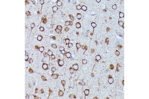Immunohistochemistry of paraffin-embedded rat brain using DDX6 antibody (ABIN7266704) at dilution of 1:100 (40x lens). (DDX6 antibody  (C-Term))