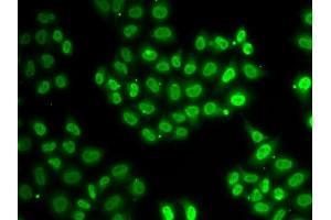 Immunofluorescence analysis of HeLa cells using EWSR1 antibody (ABIN5970844).