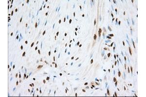 Image no. 10 for anti-Transforming, Acidic Coiled-Coil Containing Protein 3 (TACC3) antibody (ABIN1498096)
