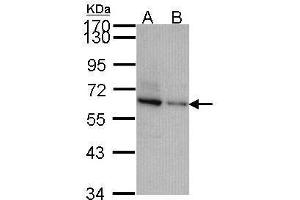 WB Image Sample (30 ug of whole cell lysate) A: JurKat B: NT2D1 7. (TOM1L2 antibody  (C-Term))