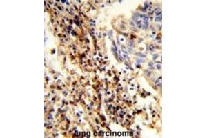 Immunohistochemistry (IHC) image for anti-Calponin Homology Domain Containing 2 (CHDC2) antibody (ABIN3003994) (CXorf22 antibody)