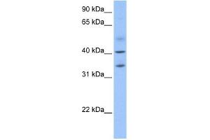 ZC3H14 antibody used at 1 ug/ml to detect target protein. (ZC3H14 antibody  (N-Term))