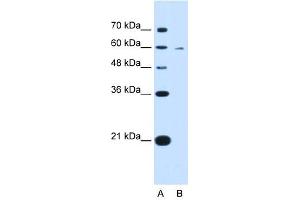 KYNU antibody used at 0.