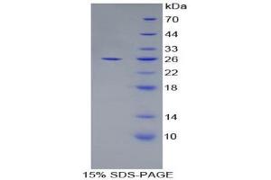 SDS-PAGE (SDS) image for Apolipoprotein F (APOF) (AA 111-314) protein (His tag) (ABIN2124042) (Apolipoprotein F Protein (APOF) (AA 111-314) (His tag))