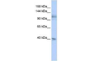 MSH2 antibody used at 1 ug/ml to detect target protein. (MSH2 antibody)