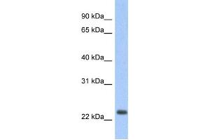 Western Blotting (WB) image for anti-Mitochondrially Encoded NADH Dehydrogenase 6 (MT-ND6) antibody (ABIN2459383) (MT-ND6 antibody)