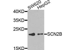 Western blot analysis of extracts of SW620 and HepG2 cells, using SCN2B antibody. (SCN2B antibody)