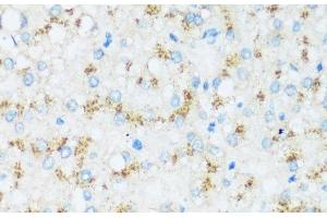 Immunohistochemistry of paraffin-embedded Human liver using APOD Polyclonal Antibody at dilution of 1:100 (40x lens). (Apolipoprotein D antibody)