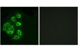 Immunofluorescence analysis of HeLa cells, using PI3-kinase p85-alpha/gamma (Ab-467/199) Antibody. (PI3K p85 alpha/gamma antibody  (AA 436-485))