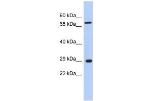 AKTIP antibody used at 1 ug/ml to detect target protein. (AKTIP antibody  (Middle Region))