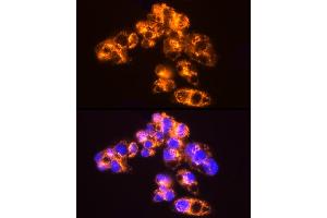 Immunofluorescence analysis of HepG2 cells using [KO Validated]  Rabbit mAb (ABIN7265466) at dilution of 1:25 (40x lens). (Adenylate Kinase 2 antibody)