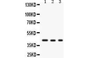 Western Blotting (WB) image for anti-Growth Associated Protein 43 (GAP43) (AA 216-238), (C-Term) antibody (ABIN3043685) (GAP43 antibody  (C-Term))