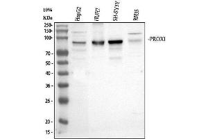Western blot analysis of PROX1 using anti-PROX1 antibody (ABIN7601937).