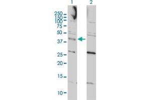 Western Blot analysis of CCNK expression in transfected 293T cell line by CCNK monoclonal antibody (M01), clone 3B7-1B9.
