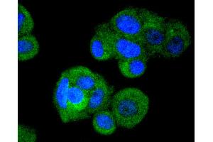 MCF-7 cells were stained with IRF3 (4C3) Monoclonal Antibody  at [1:200] incubated overnight at 4C, followed by secondary antibody incubation, DAPI staining of the nuclei and detection. (IRF3 antibody)