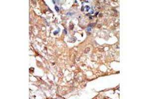 Image no. 2 for anti-V-Raf-1 Murine Leukemia Viral Oncogene Homolog 1 (RAF1) (N-Term) antibody (ABIN360145) (RAF1 antibody  (N-Term))