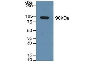 Detection of GSN in Human Serum using Polyclonal Antibody to Gelsolin (GSN) (Gelsolin antibody  (AA 674-782))
