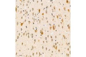 Immunohistochemistry (Paraffin-embedded Sections) (IHC (p)) image for anti-UDP-Gal:betaGlcNAc beta 1,3-Galactosyltransferase, Polypeptide 4 (B3GALT4) antibody (ABIN7076137)