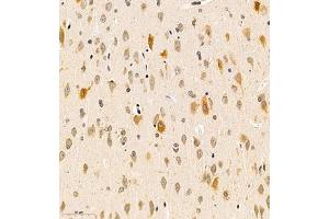 Immunohistochemistry of paraffin embedded rat brain using B3GALT4 (ABIN7076137) at dilution of 1:400 (300x lens) (B3GALT4 antibody)