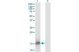 Western Blot analysis of FKBP1B expression in transfected 293T cell line by FKBP1B monoclonal antibody (M01), clone 4H5-1B6. (FKBP1B antibody  (AA 1-80))