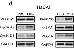 Effect of ASC-MV treatment on gene expression in all three kinds of cells. (VEGFR2/CD309 antibody  (AA 1150-1250))
