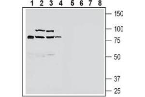 Western blot analysis of rat small intestine lysate (lanes 1 and 5), mouse liver lysate (lanes 2 and 6), rat liver lysate (lanes 3 and 7) and rat brain lysate (lanes 4 and 8):1-4. (Solute Carrier Family 30, Member 10 (SLC30A10) Peptide)