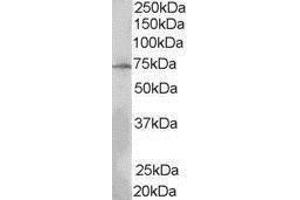 Western Blotting (WB) image for anti-SH2B Adaptor Protein 3 (SH2B3) (N-Term) antibody (ABIN2475350) (SH2B3 antibody  (N-Term))