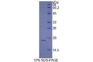 SDS-PAGE analysis of Human Cyclophilin A Protein.