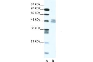 Western Blotting (WB) image for anti-Thyroid Hormone Receptor Interactor 13 (TRIP13) antibody (ABIN2461196) (TRIP13 antibody)