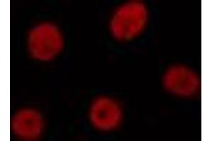 ABIN6274371 staining HuvEc cells by IF/ICC. (MED1 antibody  (C-Term))
