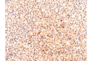 Immunohistochemistry (IHC) image for anti-Tumor Protein P53 (TP53) (acLys319) antibody (ABIN6254862)