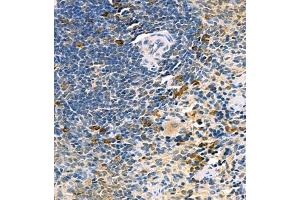 Immunohistochemistry of paraffin embedded rat spleen using UBE2J1 (ABIN7076117) at dilution of 1:400 (400x lens) (UBE2J1 antibody)