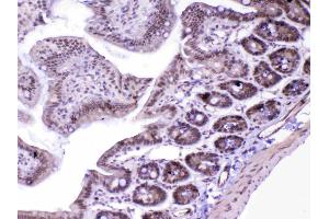 IHC analysis of MED18 using anti-MED18 antibody . (MED18 antibody  (AA 1-208))