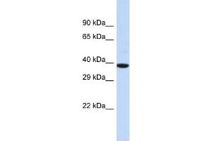 Host:  Rabbit  Target Name:  NOX4  Sample Type:  MCF7 Whole Cell lysates  Antibody Dilution:  1. (NADPH Oxidase 4 antibody  (Middle Region))