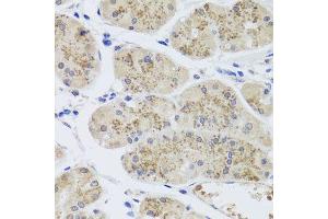 Immunohistochemistry of paraffin-embedded human stomach using MTERFD3 antibody (ABIN5974877) at dilution of 1/100 (40x lens). (MTERFD3 antibody)