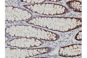 Image no. 1 for anti-WNK Lysine Deficient Protein Kinase 2 (WNK2) (AA 2118-2218) antibody (ABIN599299) (WNK2 antibody  (AA 2118-2218))