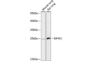 Western blot analysis of extracts of various cell lines, using EIF4E3 antibody (ABIN6130367, ABIN6140088, ABIN6140089 and ABIN6218034) at 1:3000 dilution. (EIF4E3 antibody  (AA 1-118))