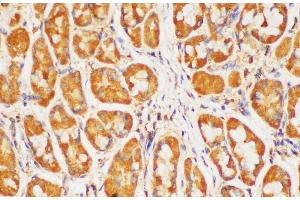 Immunohistochemistry of paraffin-embedded Human stomach using HRAS Polycloanl Antibody at dilution of 1:200 (HRAS antibody)