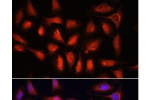 Immunofluorescence analysis of U-2 OS cells using IRF1 Polyclonal Antibody at dilution of 1:100. (IRF1 antibody)